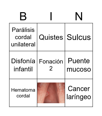 patologías vocales Bingo Card