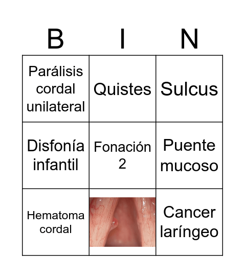patologías vocales Bingo Card