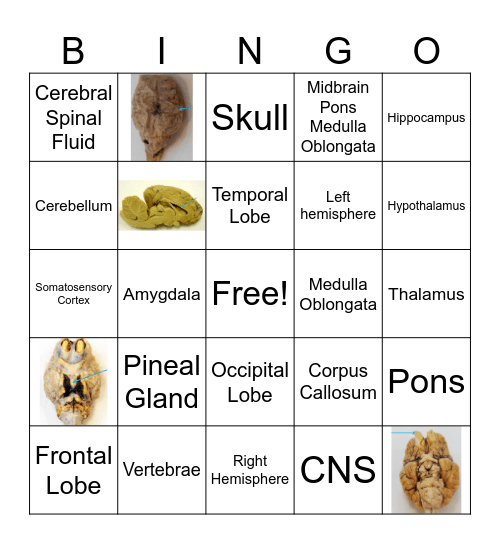 Central Nervous System Bingo Card