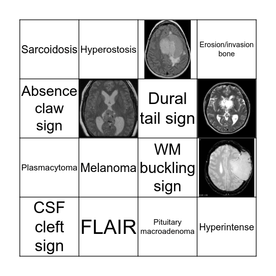 Extra axial mass bingo Card