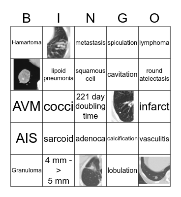 Lung Nodule Bingo  Bingo Card