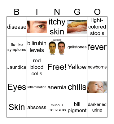 Jaundice Bingo Card