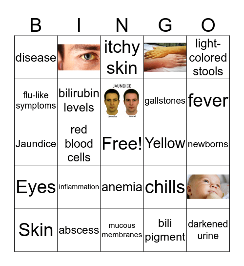 Jaundice Bingo Card