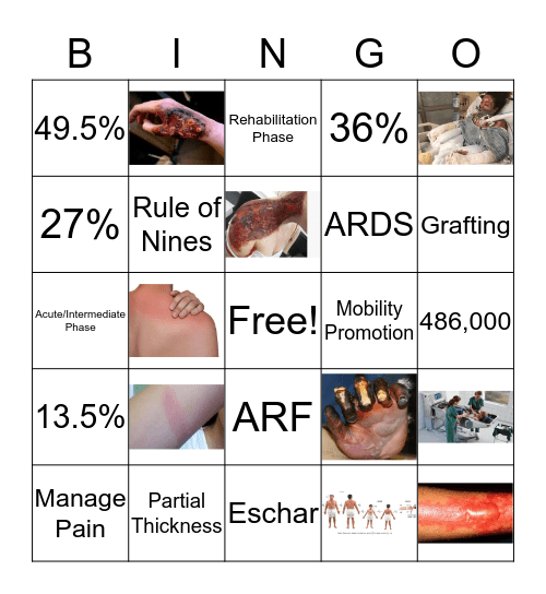 Burn Bingo Card