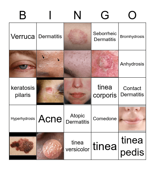 Disorders of the Skin Ch.11 Bingo Card
