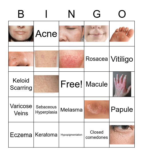 Skin Disorders & Diseases BINGO Card