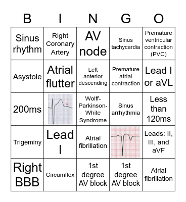 EKG basics Bingo Card