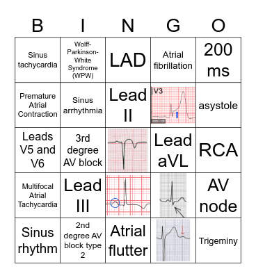 EKG basics Bingo Card