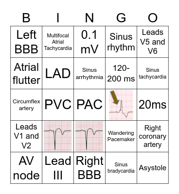 EKG basics Bingo Card