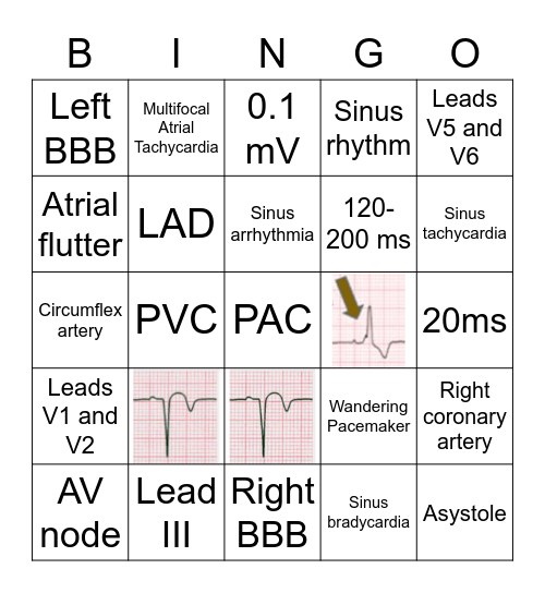 EKG basics Bingo Card