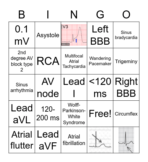 EKG basics Bingo Card