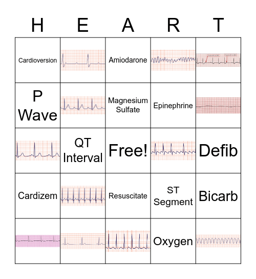 EKG Bingo Card