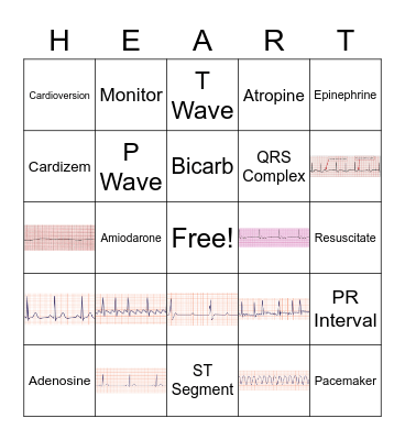 EKG Bingo Card