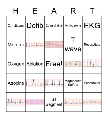 EKG Bingo Card