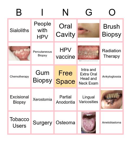 Dental Pathology/Oncology Bingo Card