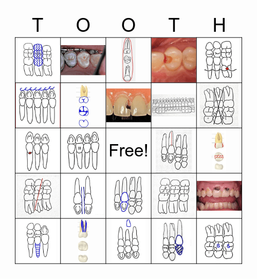 Dental Charting Symbols Bingo Card