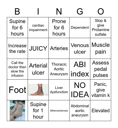 Circulatory Disorders Bingo Card