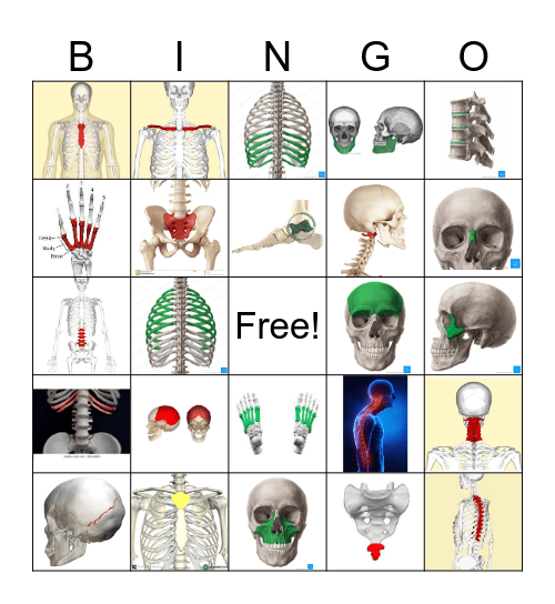 Skeletal Bones and Disorders Bingo Card