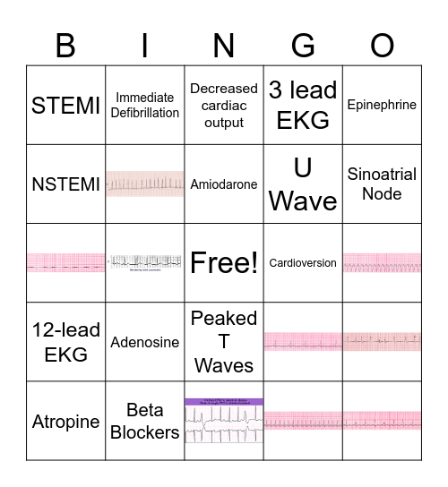 EKG Bingo Card