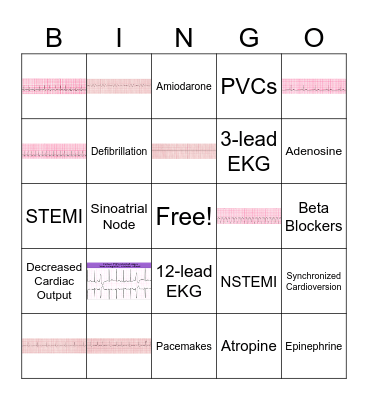 EKG Bingo Card