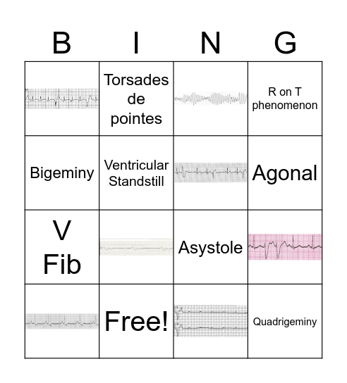 Ventricular Dysrhythmias Bingo Card