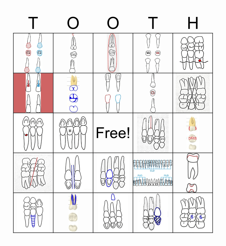 Dental Charting Symbols Bingo Card