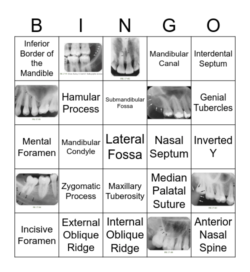 Dental Radiographic Anatomical Landmarks Bingo Card