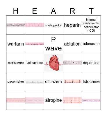 NUR 210 EKG Bingo Card