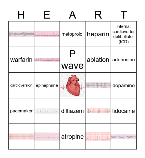 NUR 210 EKG Bingo Card