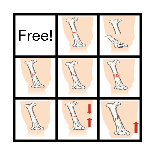 Fracture Bingo Card