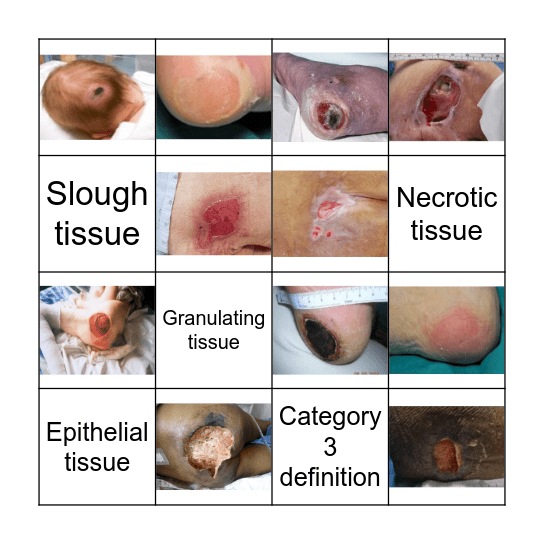 PRESSURE ULCER BINGO Card